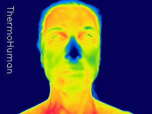 Thermography scan of the face and neck